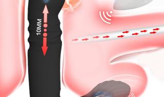 怎么按摩前列腺 怎么按摩前列腺